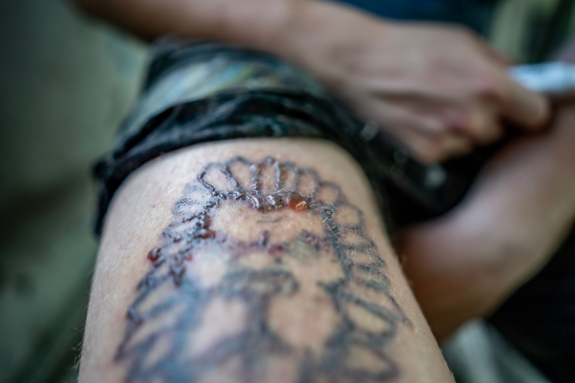 Gros plan du tatouage de guérison sur le bras pendant le processus de récupération